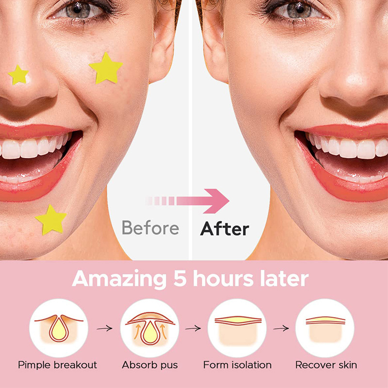 600 ピース/セットスターにきびパッチにきびカラフルな目に - Beauty In Makeup のレビューと価格